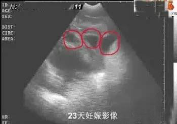 瘦肉精檢測(cè)卡|瘦肉精三聯(lián)檢測(cè)卡|克倫檢測(cè)|萊克檢測(cè)|沙丁檢測(cè)|寵物試紙|犬瘟試紙|細(xì)小試紙|寵物試紙代加工|寵物試紙批發(fā)|動(dòng)物撲殺器|消毒液機(jī)|一次性防護(hù)服|動(dòng)物解剖臺(tái)|采樣箱|檢疫箱|檢疫設(shè)備|寵物用品|寵物食品|狗糧|貓糧